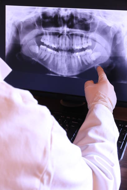 Best Emergency Dental Care for Abscessed Tooth in Naples Manor, FL