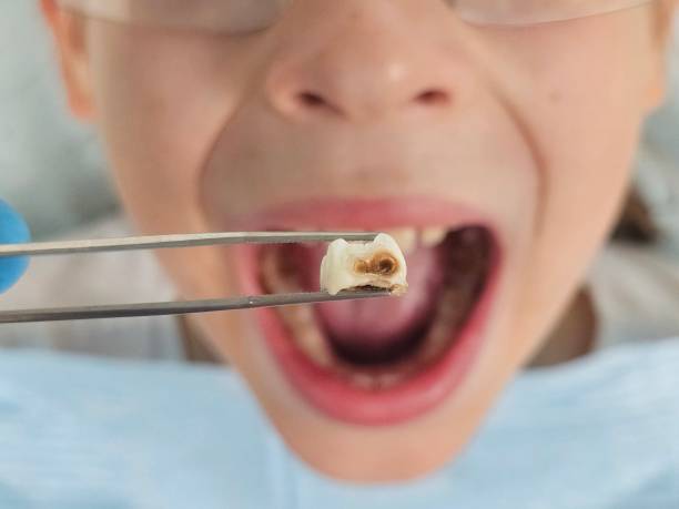 Best Emergency Dentist for Special Needs Patients in Naples Manor, FL